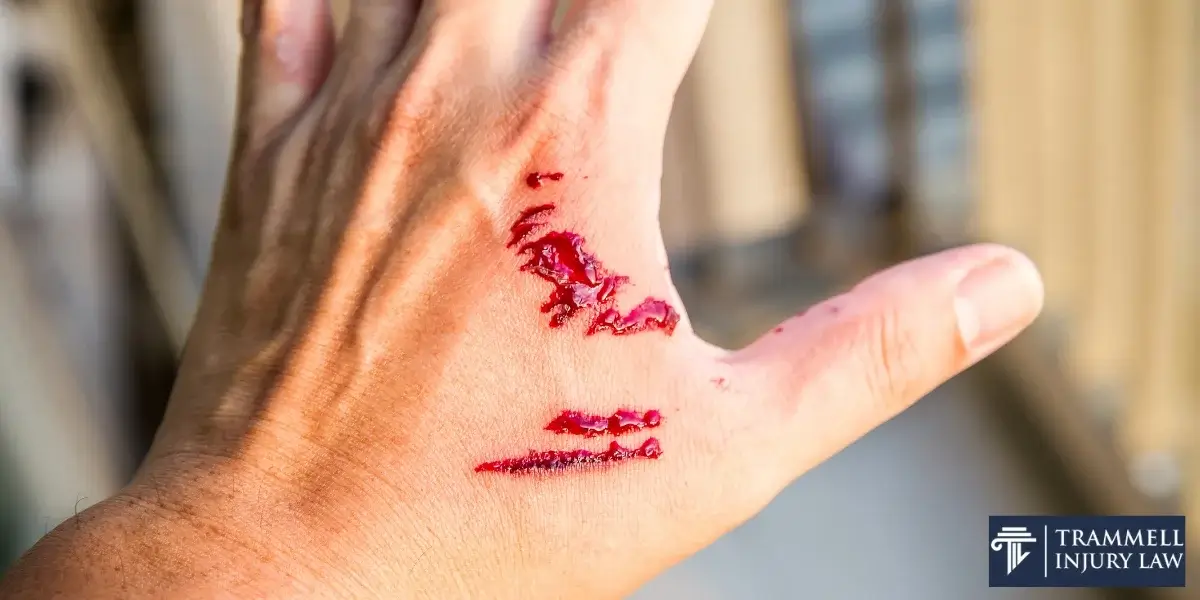 best peachtree city dog bite lawyer